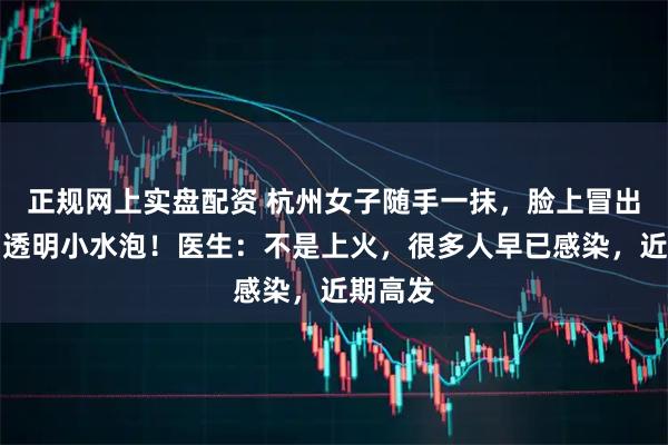 正规网上实盘配资 杭州女子随手一抹，脸上冒出一连串透明小水泡！医生：不是上火，很多人早已感染，近期高发